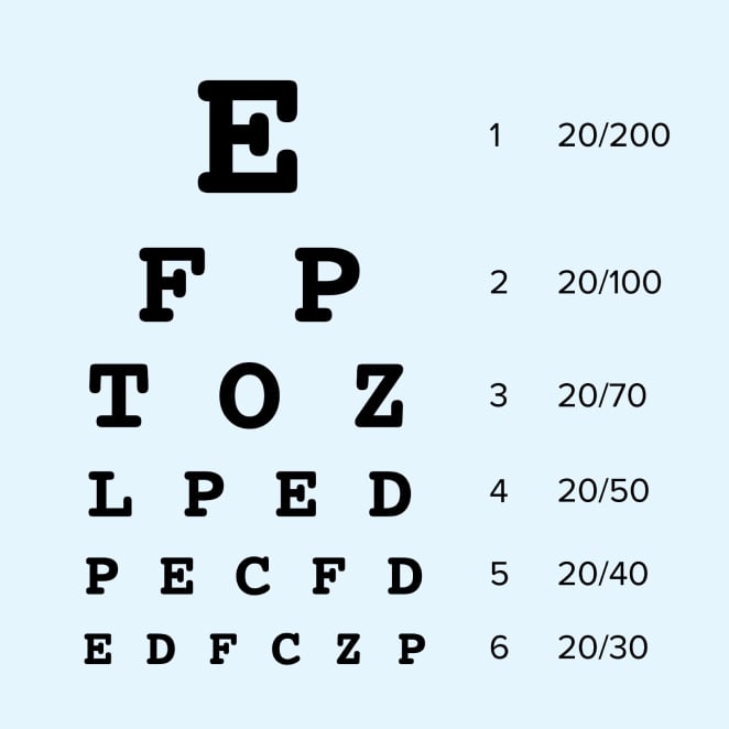 Snellen chart that patients are asked to read from during an eye exam