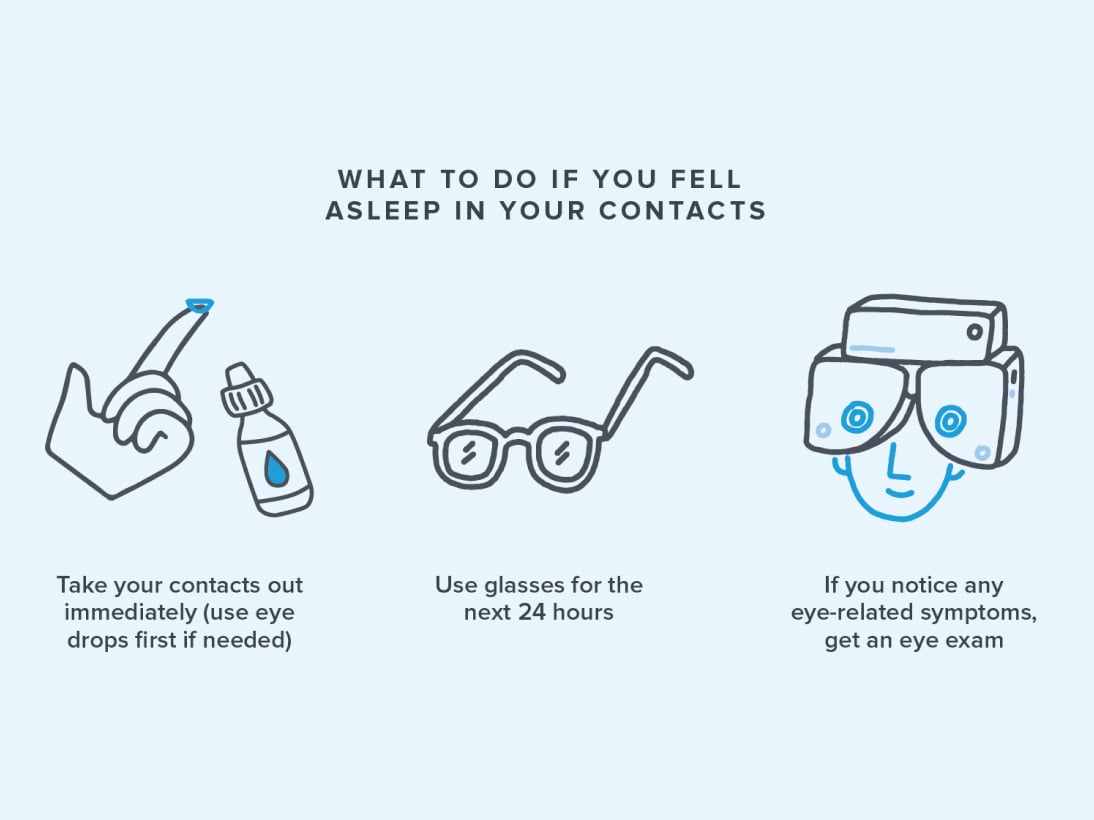 Infographic detailing what to do if you fell asleep in your contacts