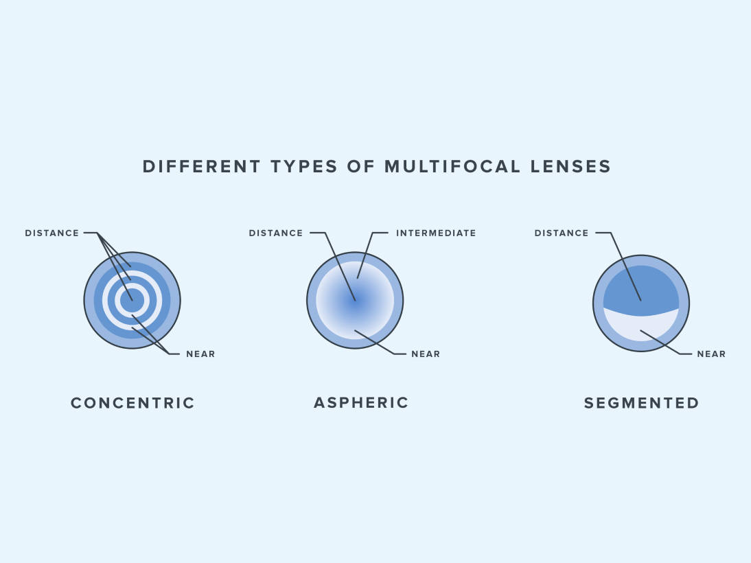 https://www.warbyparker.com/learn/wp-content/uploads/2022/11/how-do-multifocal-contacts-work-types.jpg?utm_source=chatgpt.com