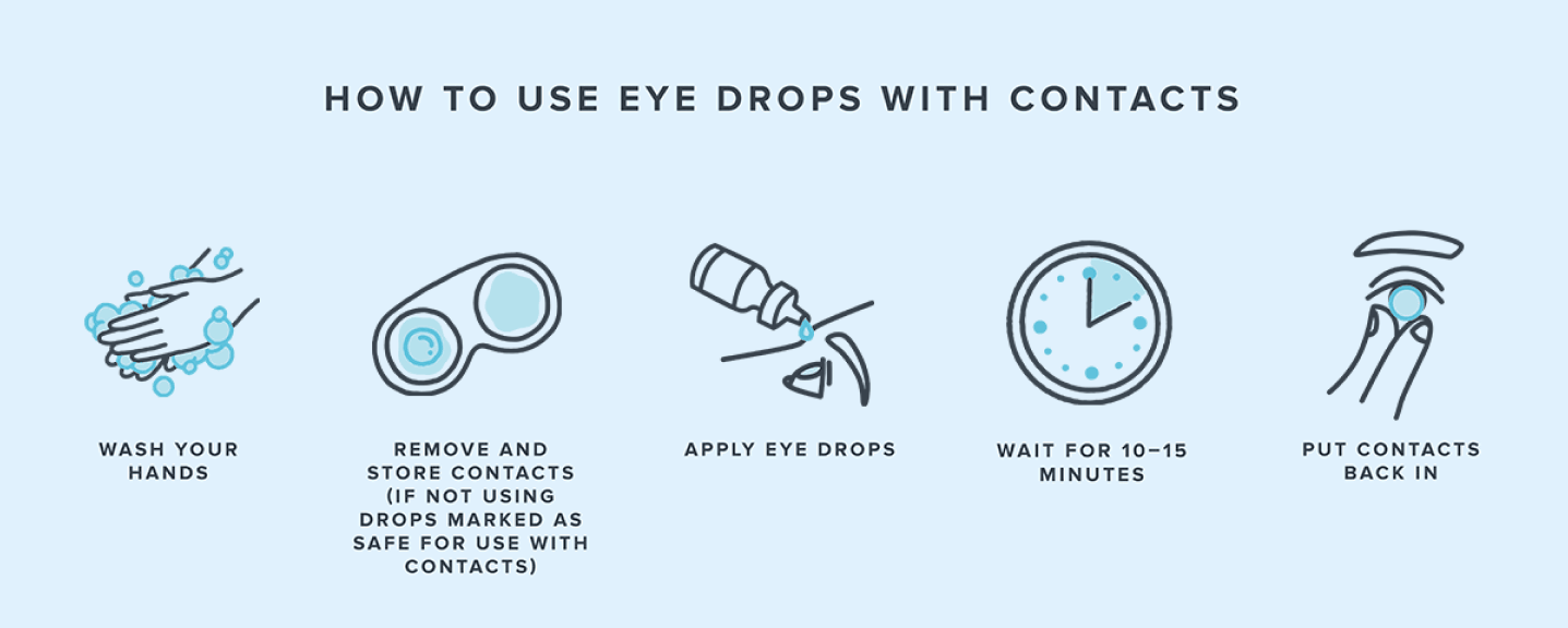 A gif displaying the five-step process for how to use eye drops with contacts