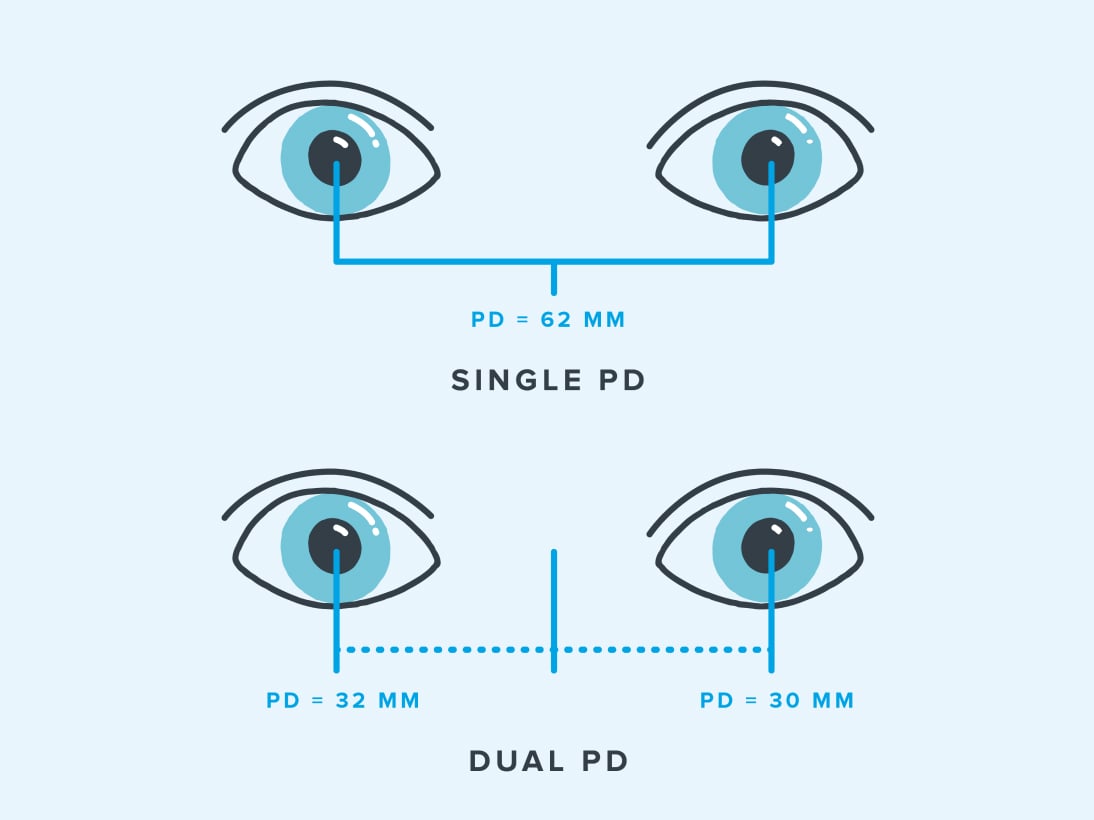 Illustration showing the difference between single and dual pupillary distance