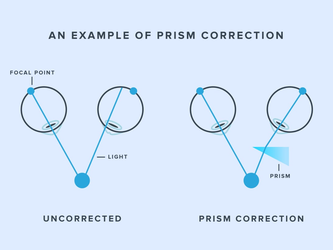Illustration showing an example of prism correction