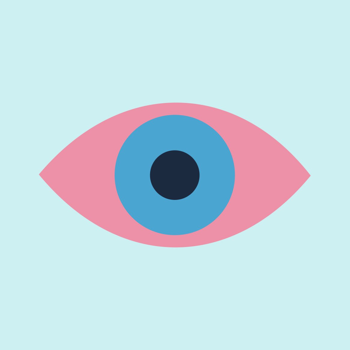 Illustration of an eye with conjunctivitis
