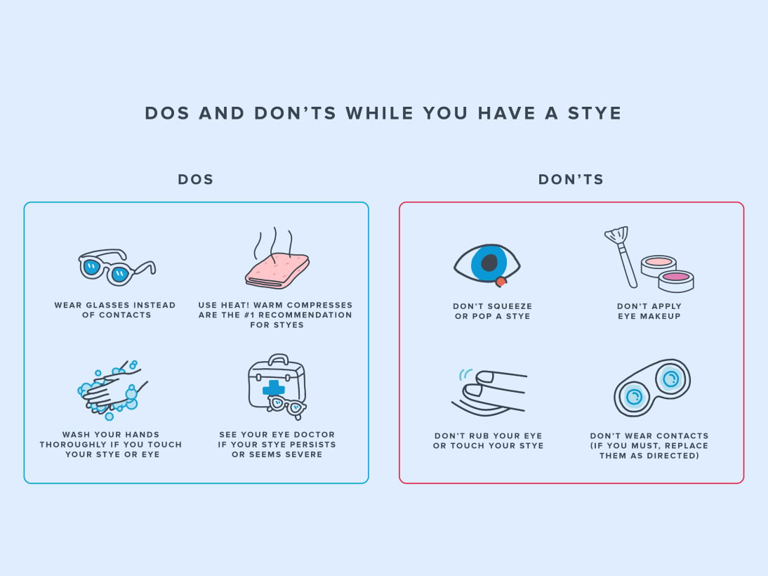 Infographic showing the dos and don'ts when you have a stye