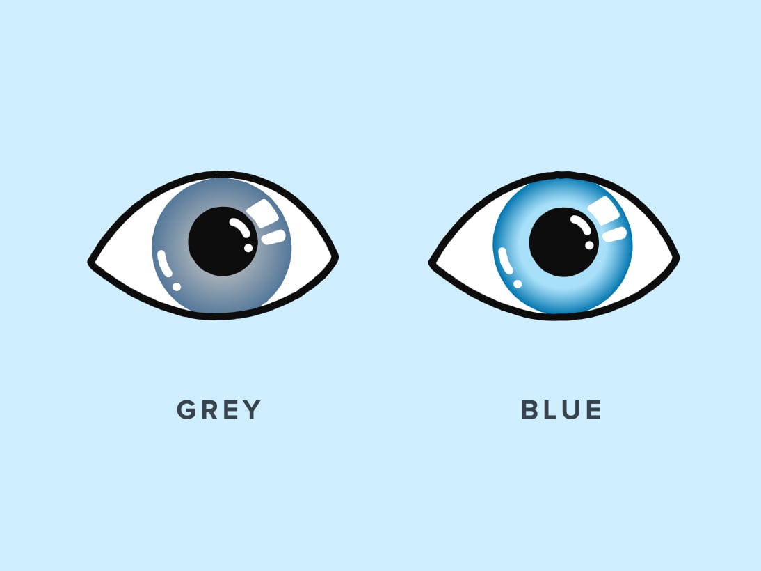 Illustration comparing a blue eye to a grey eye