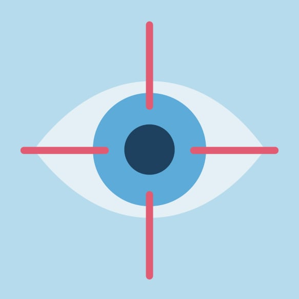 Eye in LASIK crosshairs